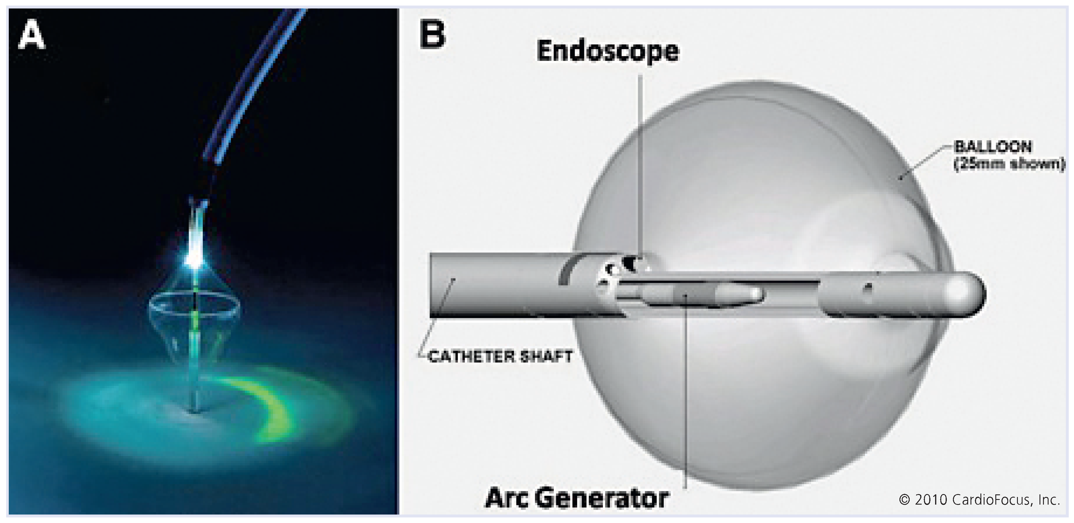 Cardiovascmed 13 00272 g013 Cardiovascmed 13 00272 g013