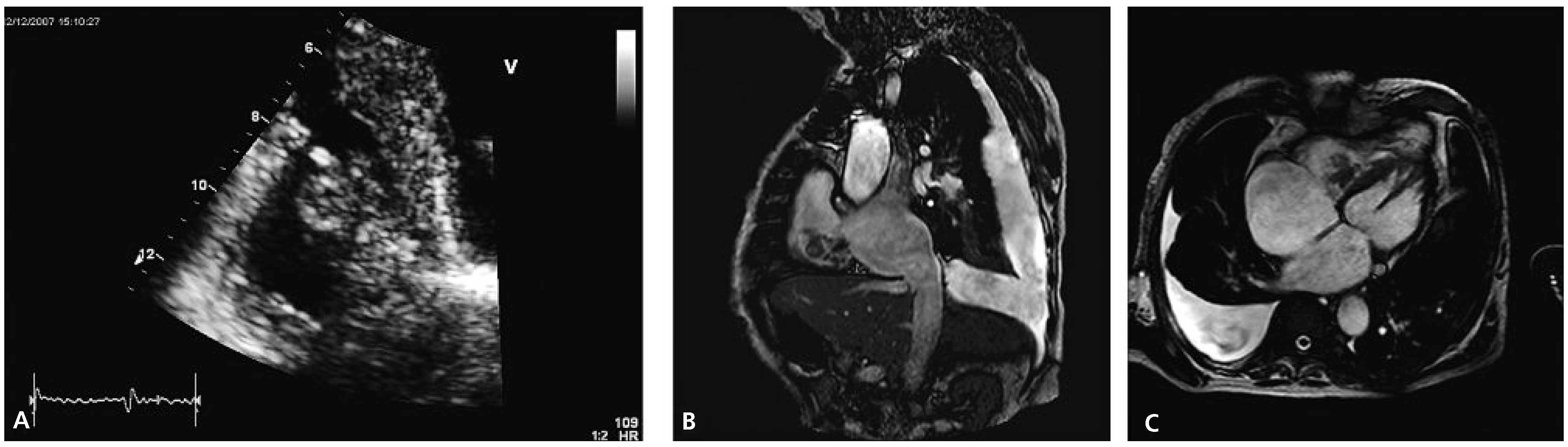 Cardiovascmed 13 00281 g001 Cardiovascmed 13 00281 g001
