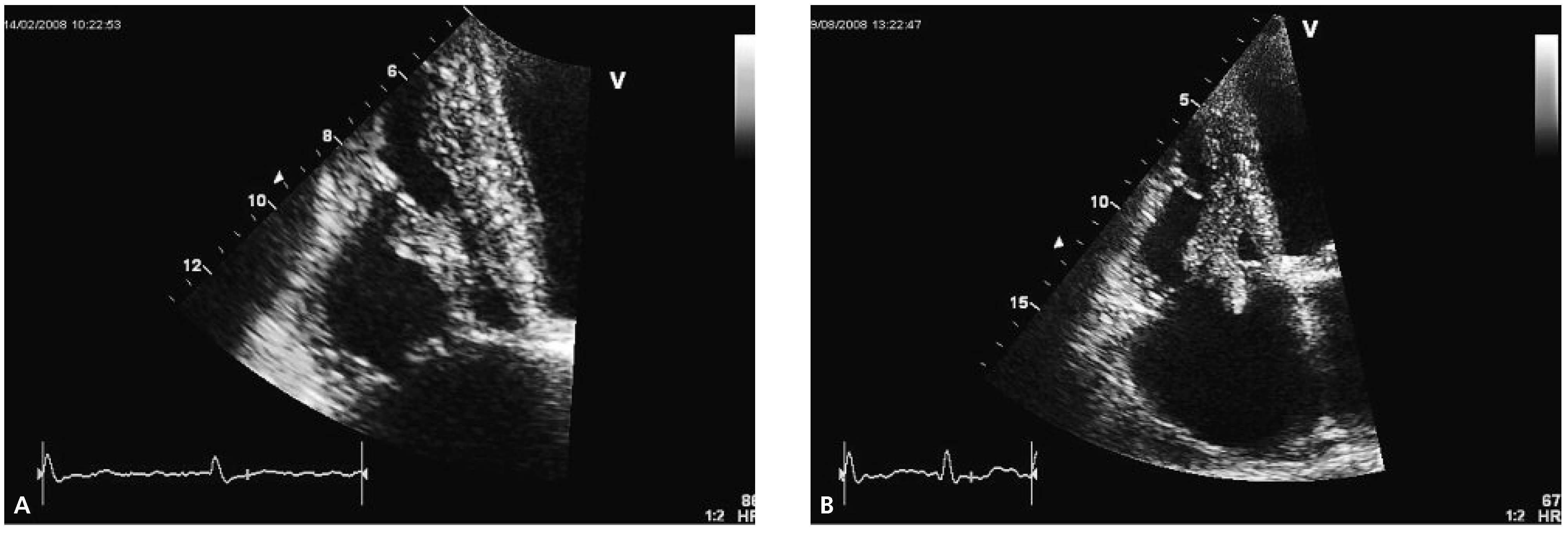 Cardiovascmed 13 00281 g002 Cardiovascmed 13 00281 g002