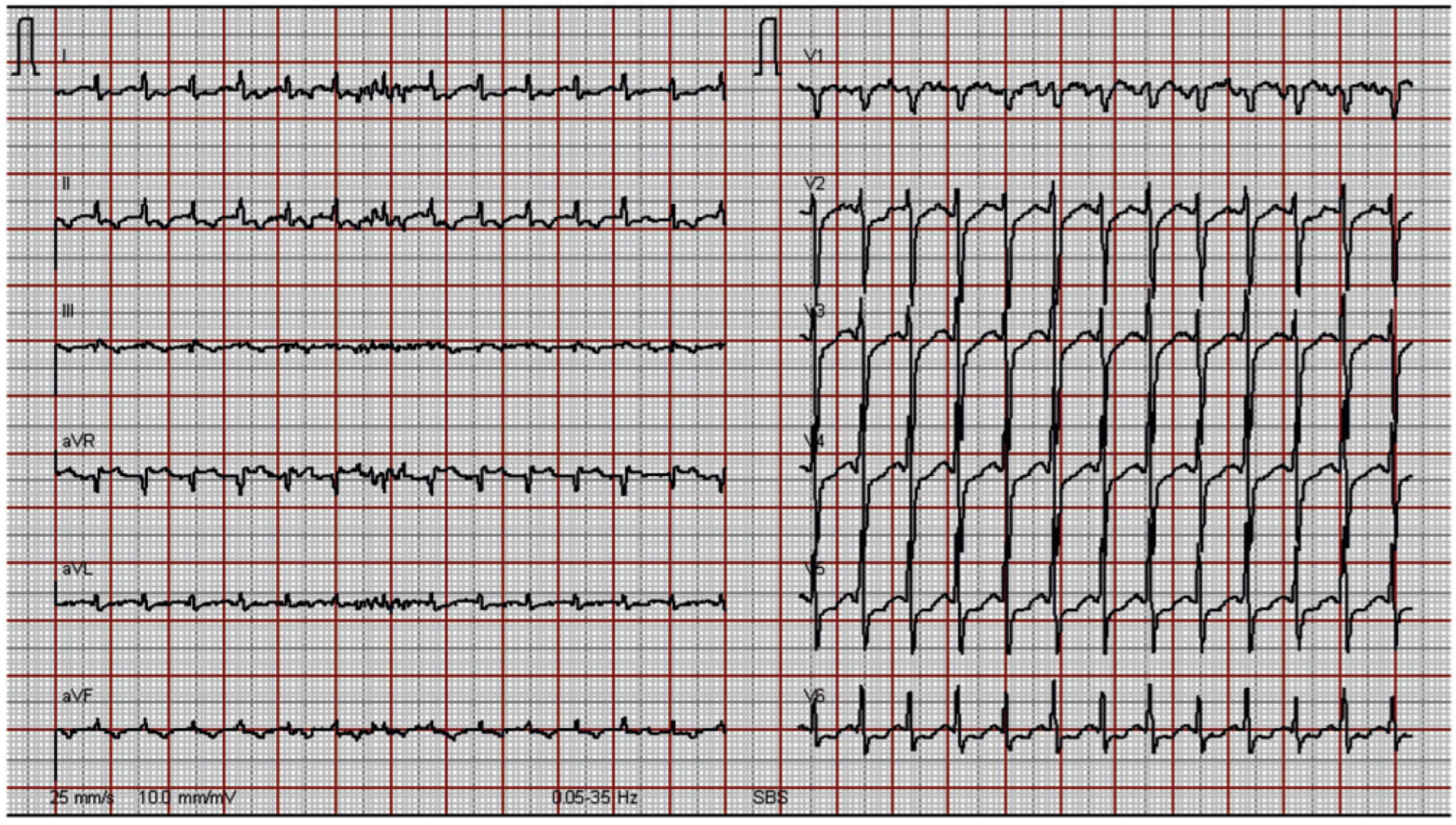 Cardiovascmed 13 00288 g001