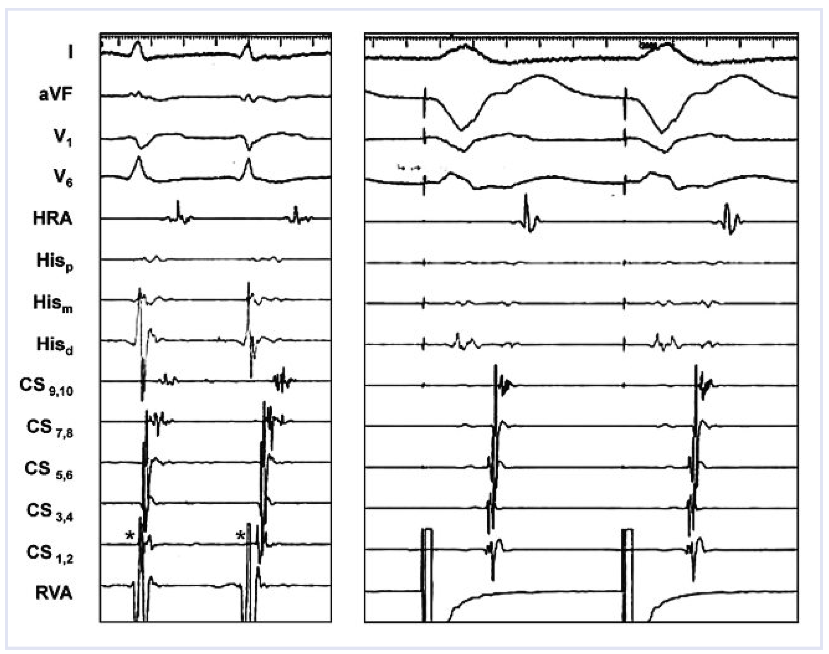 Cardiovascmed 13 00288 g002
