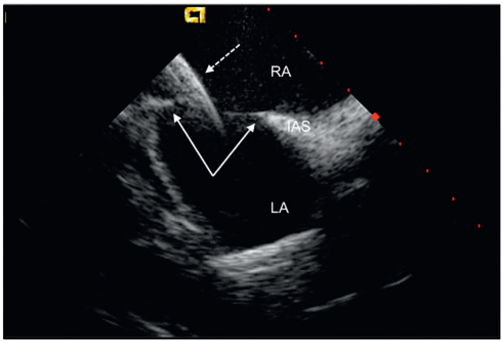 Cardiovascmed 13 00290 g001