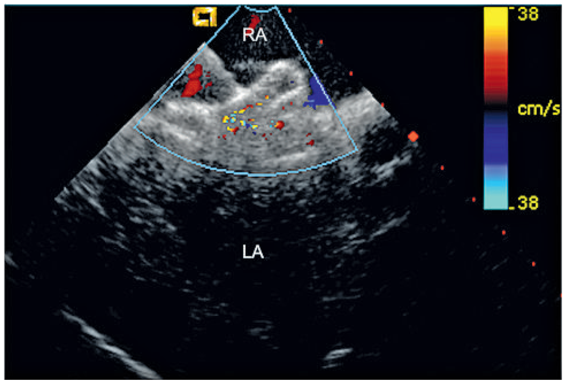 Cardiovascmed 13 00290 g003