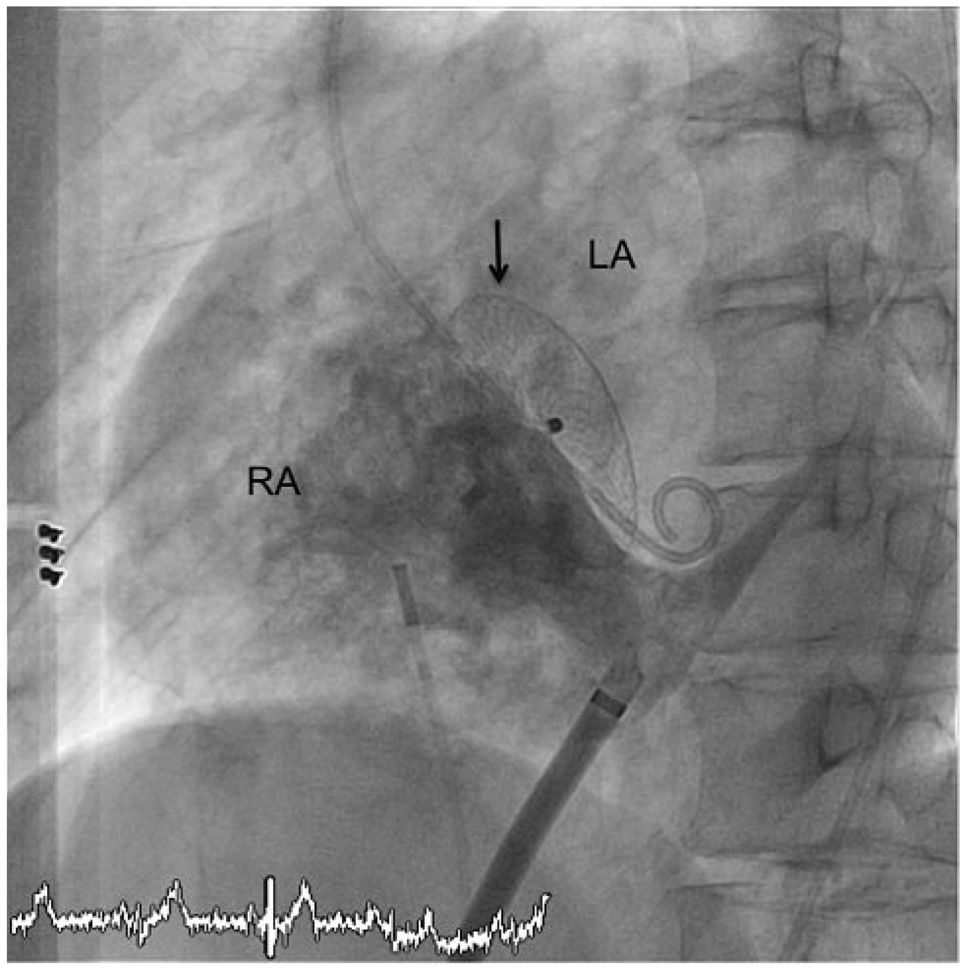 Cardiovascmed 13 00290 g004