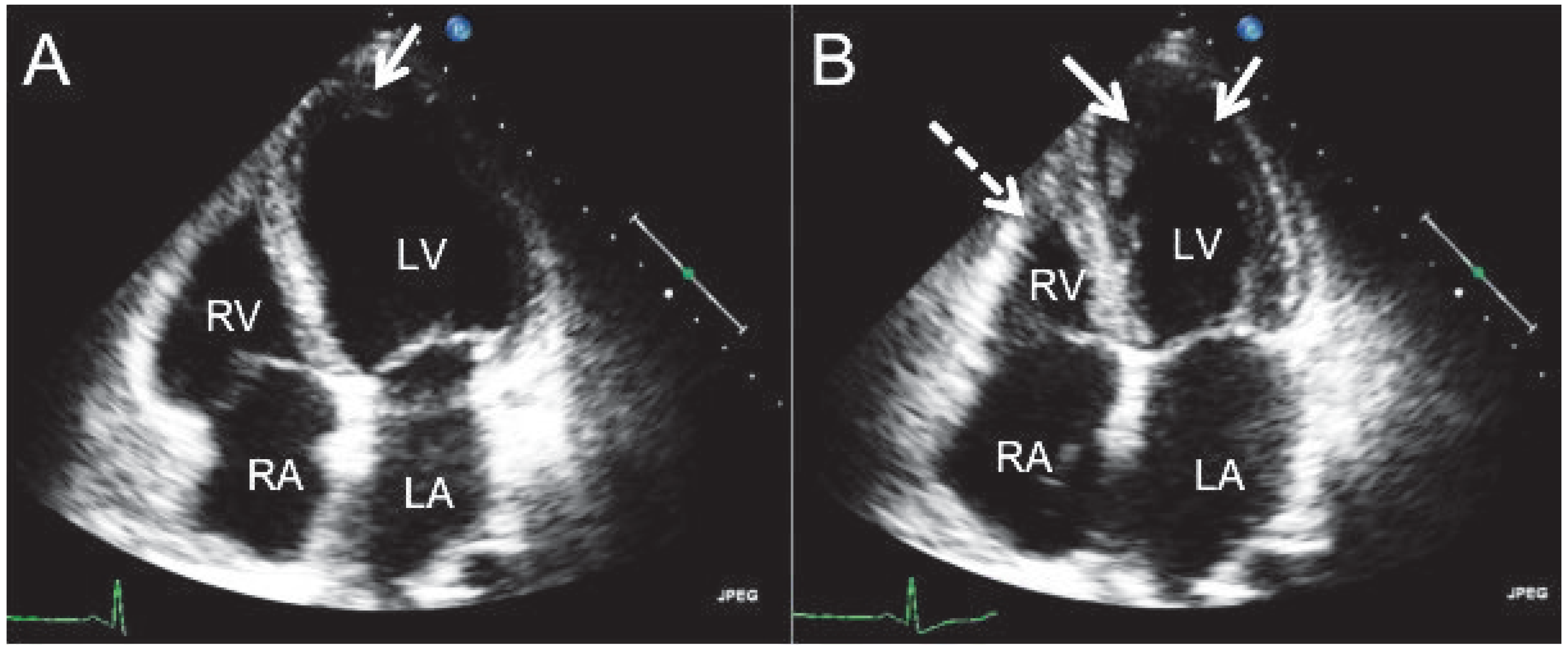 Cardiovascmed 13 00313 g002