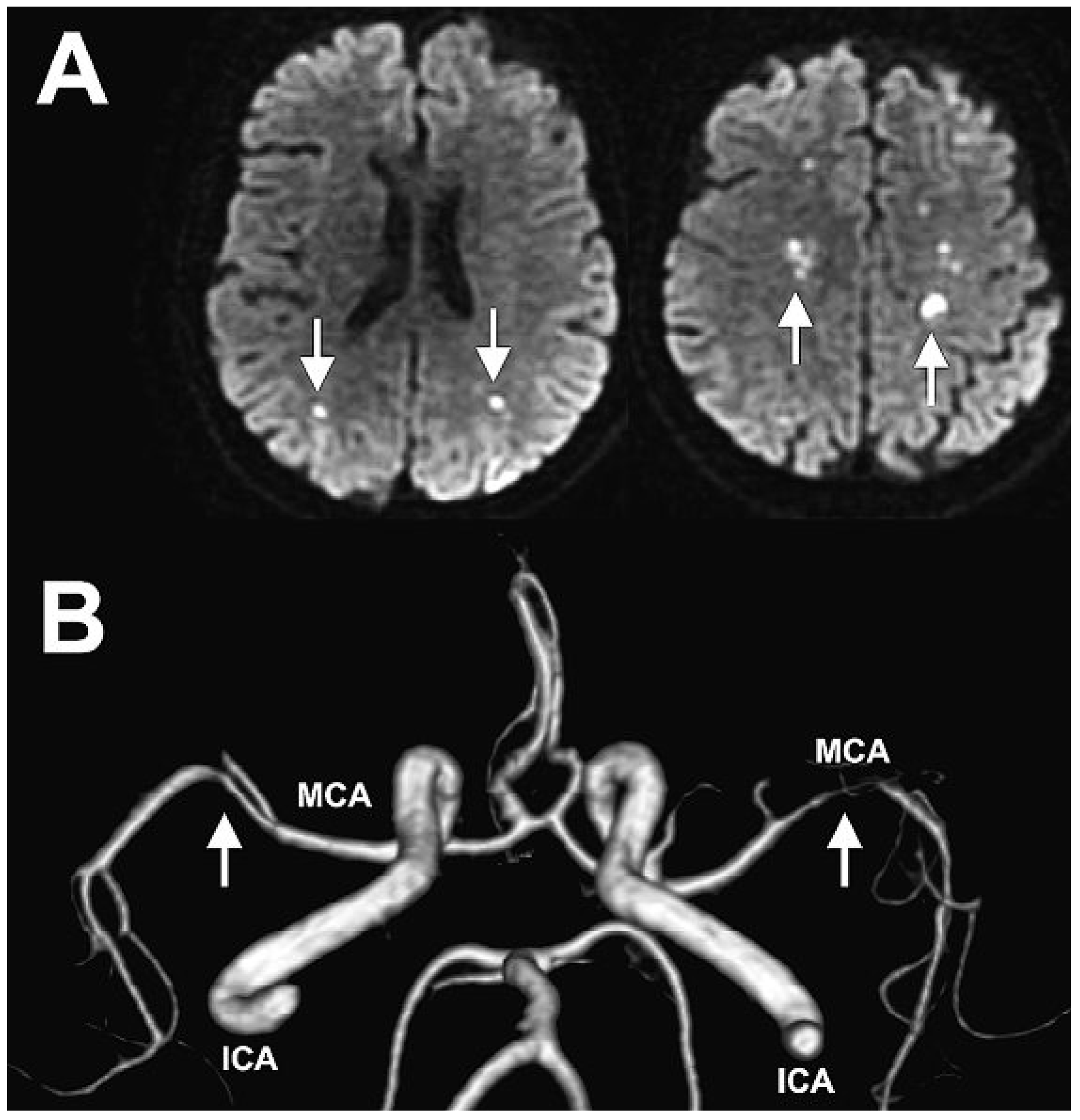 Cardiovascmed 13 00313 g003