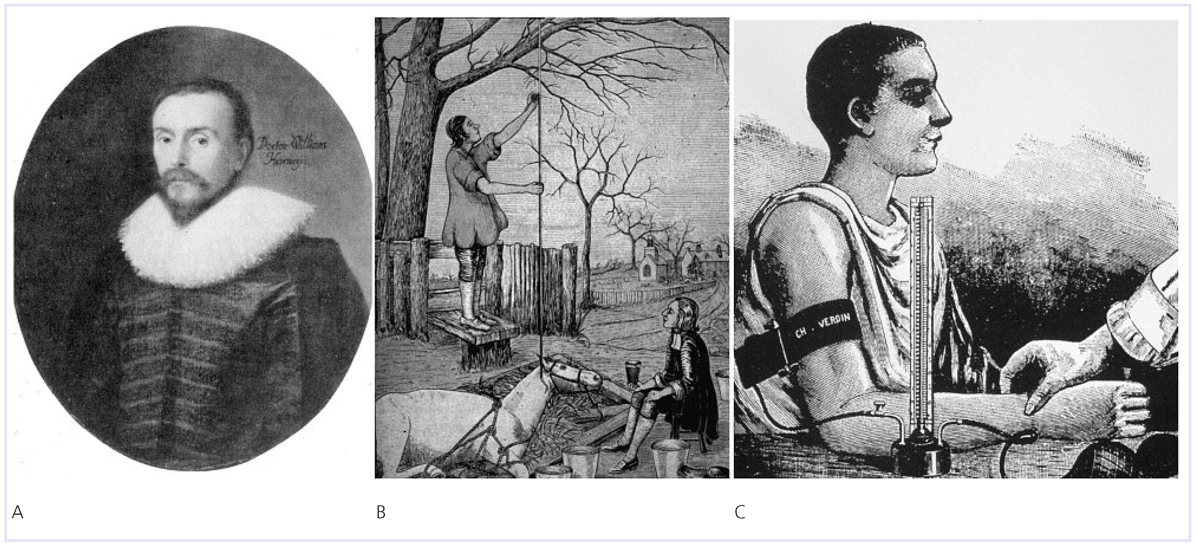 Cardiovascmed 13 00321 g001