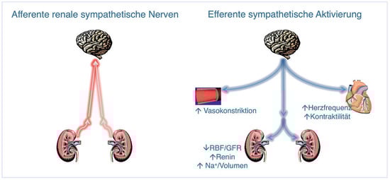 Cardiovascmed 13 00321 g005