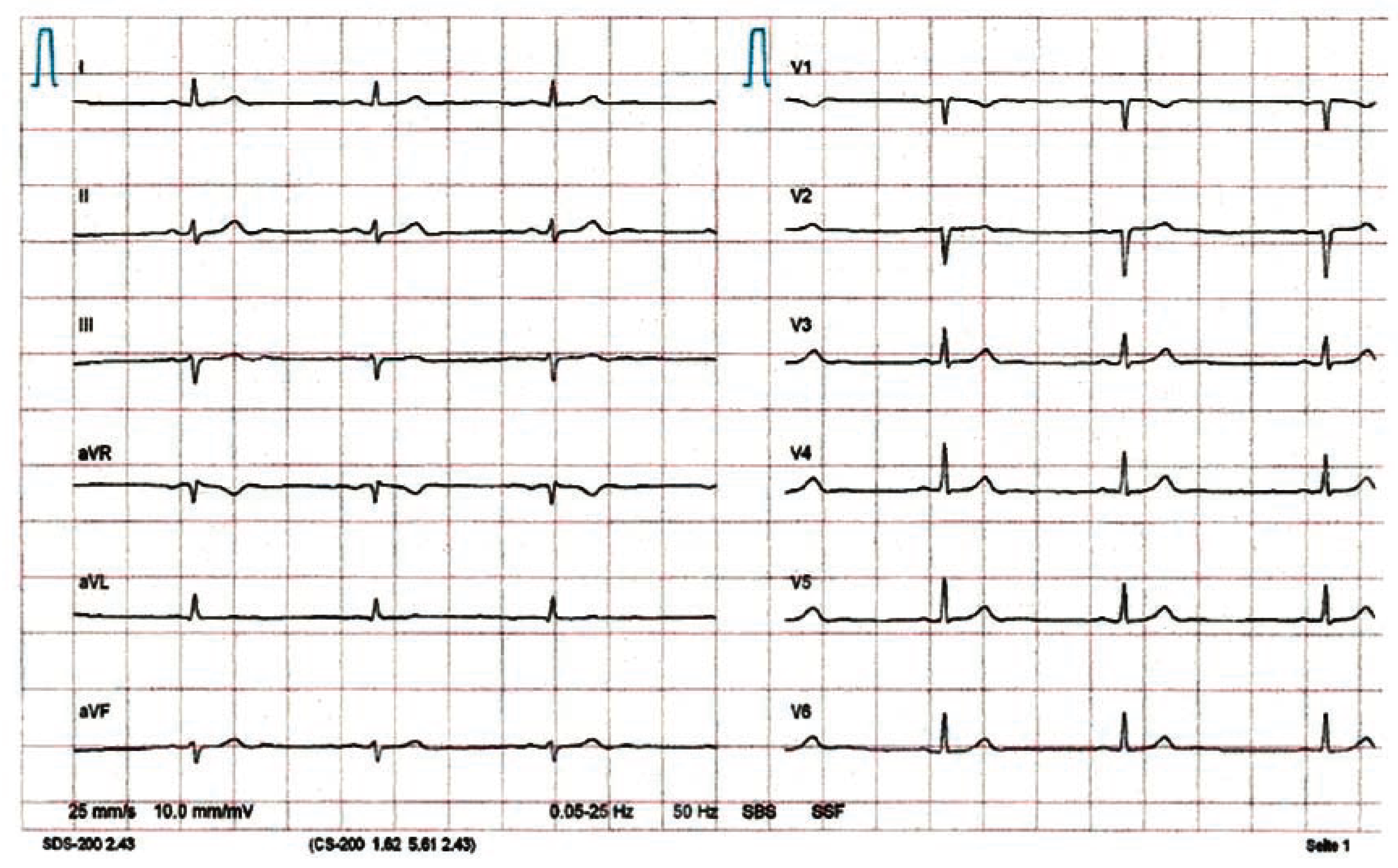 Cardiovascmed 13 00342 g001