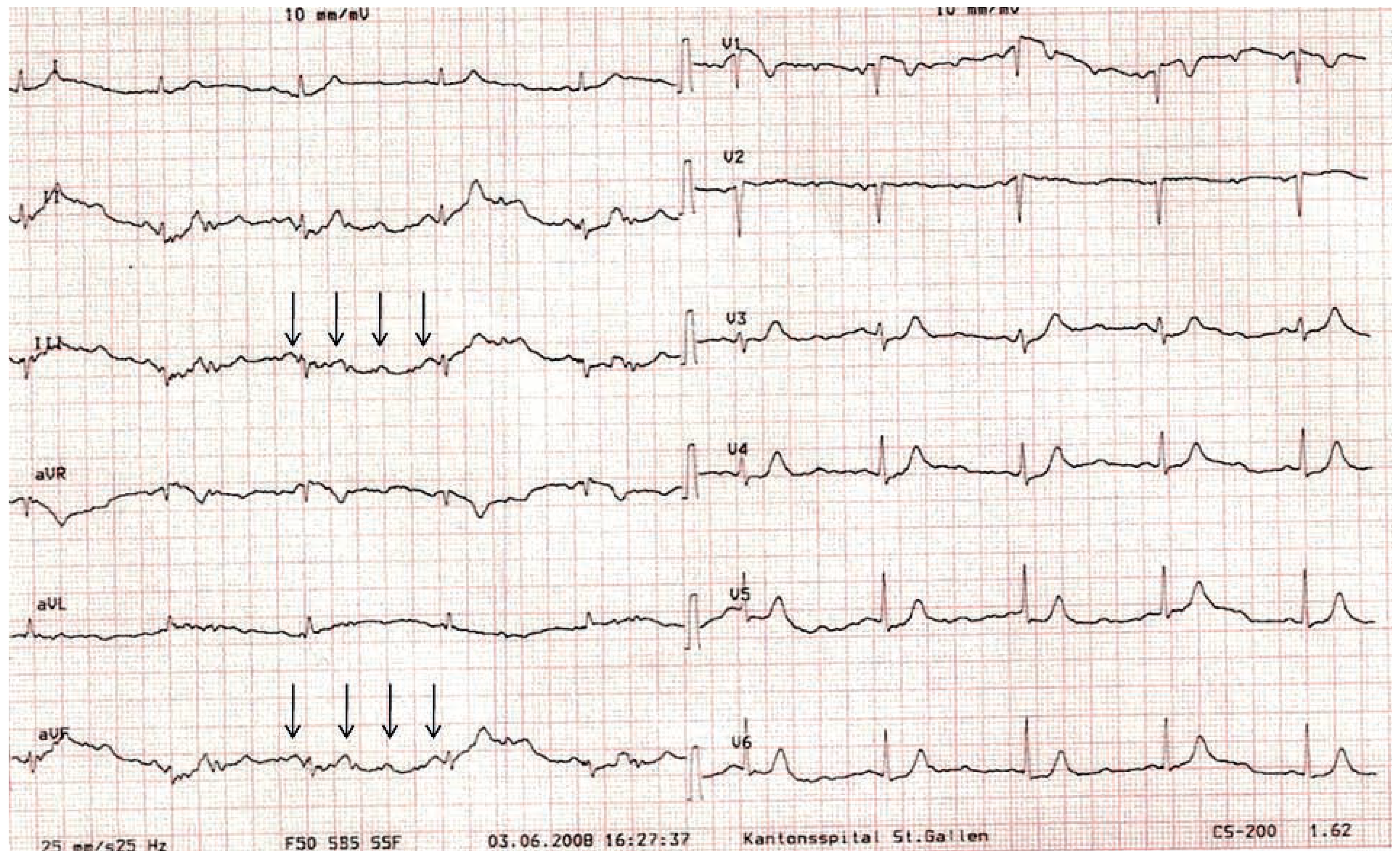 Cardiovascmed 13 00342 g003