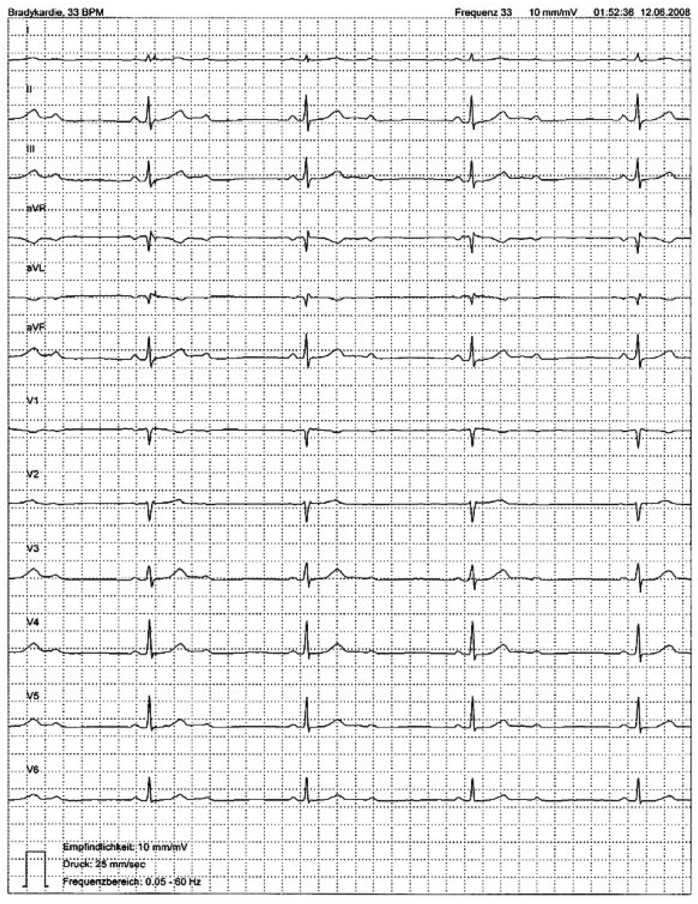 Cardiovascmed 13 00342 g004