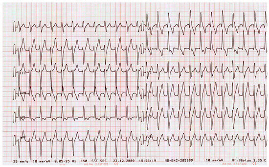 Cardiovascmed 13 00352 g001