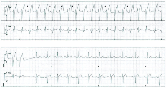 Cardiovascmed 13 00352 g002