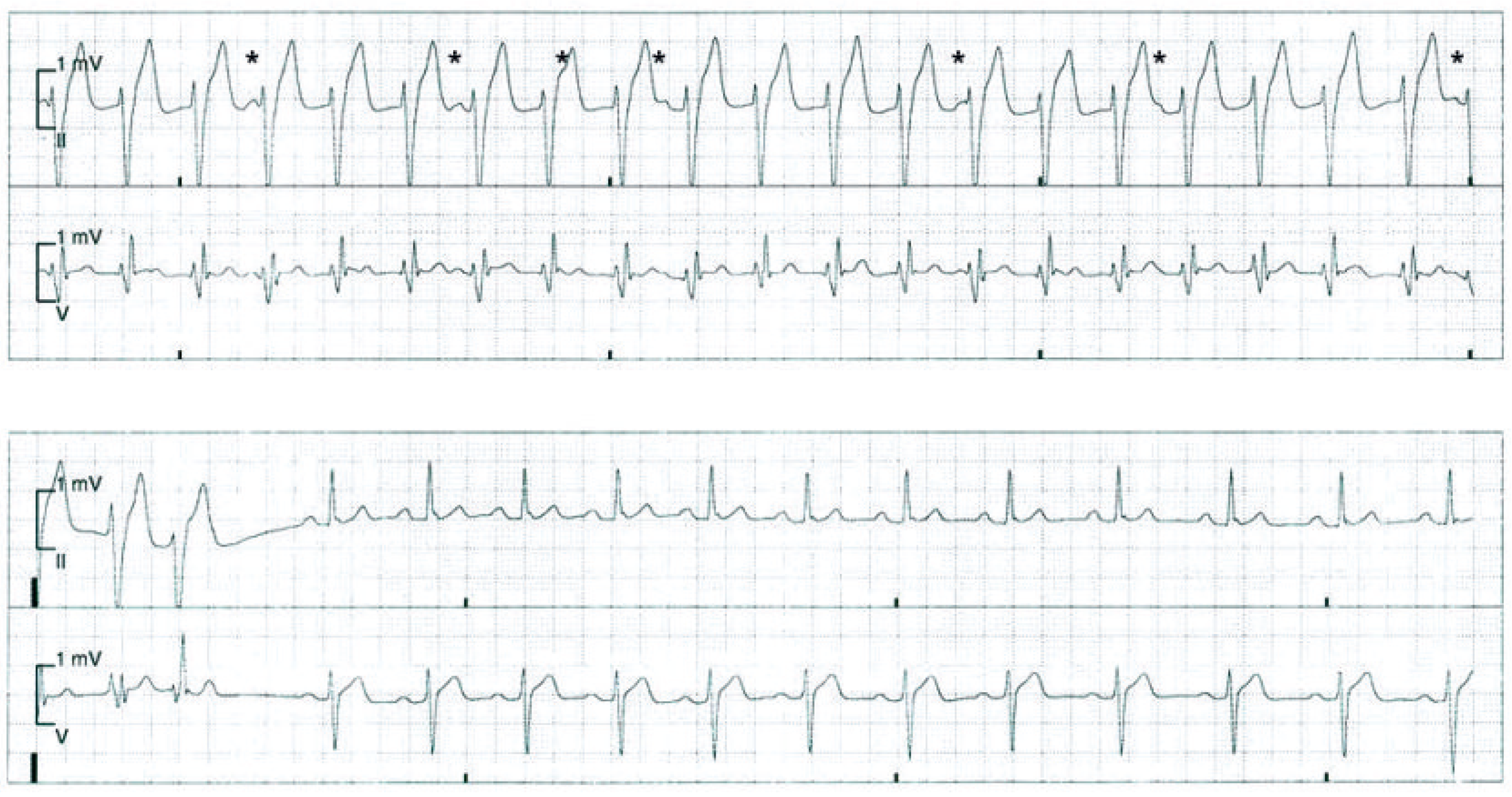 Cardiovascmed 13 00352 g002