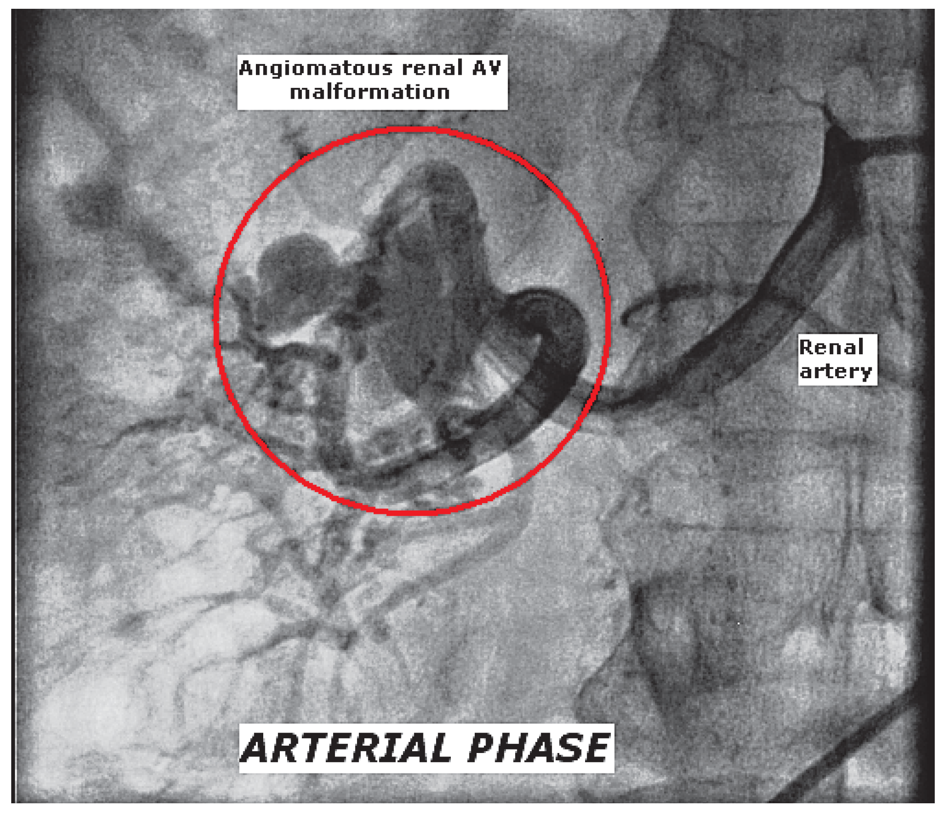 Cardiovascmed 13 00378 g001 Cardiovascmed 13 00378 g001