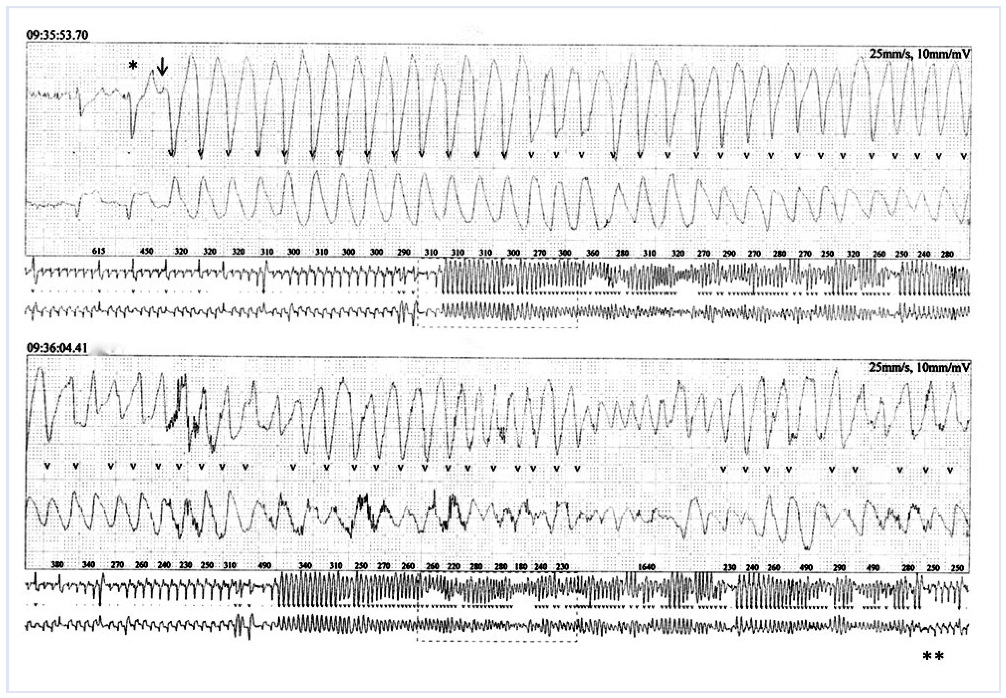 Cardiovascmed 14 00027 g001