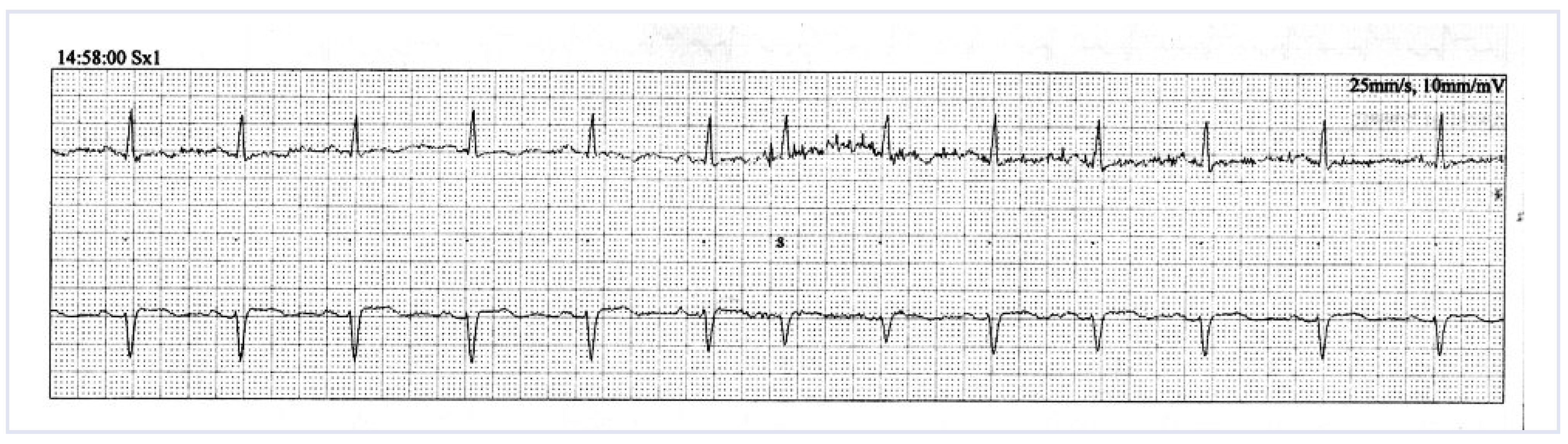 Cardiovascmed 14 00027 g002