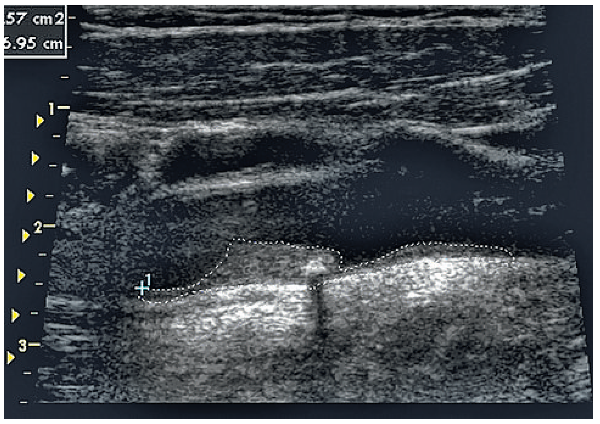 Cardiovascmed 14 00053 g001