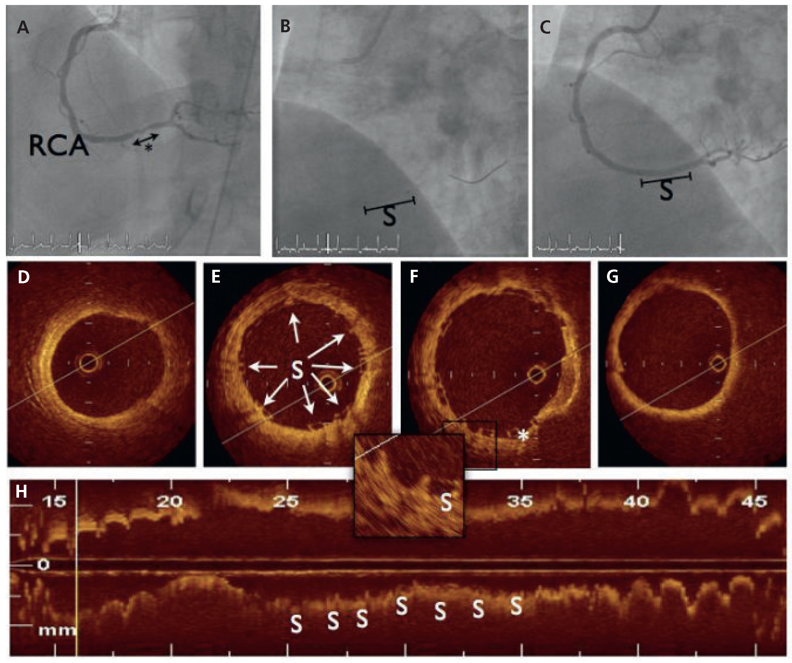 Cardiovascmed 14 00067 g001 Cardiovascmed 14 00067 g001