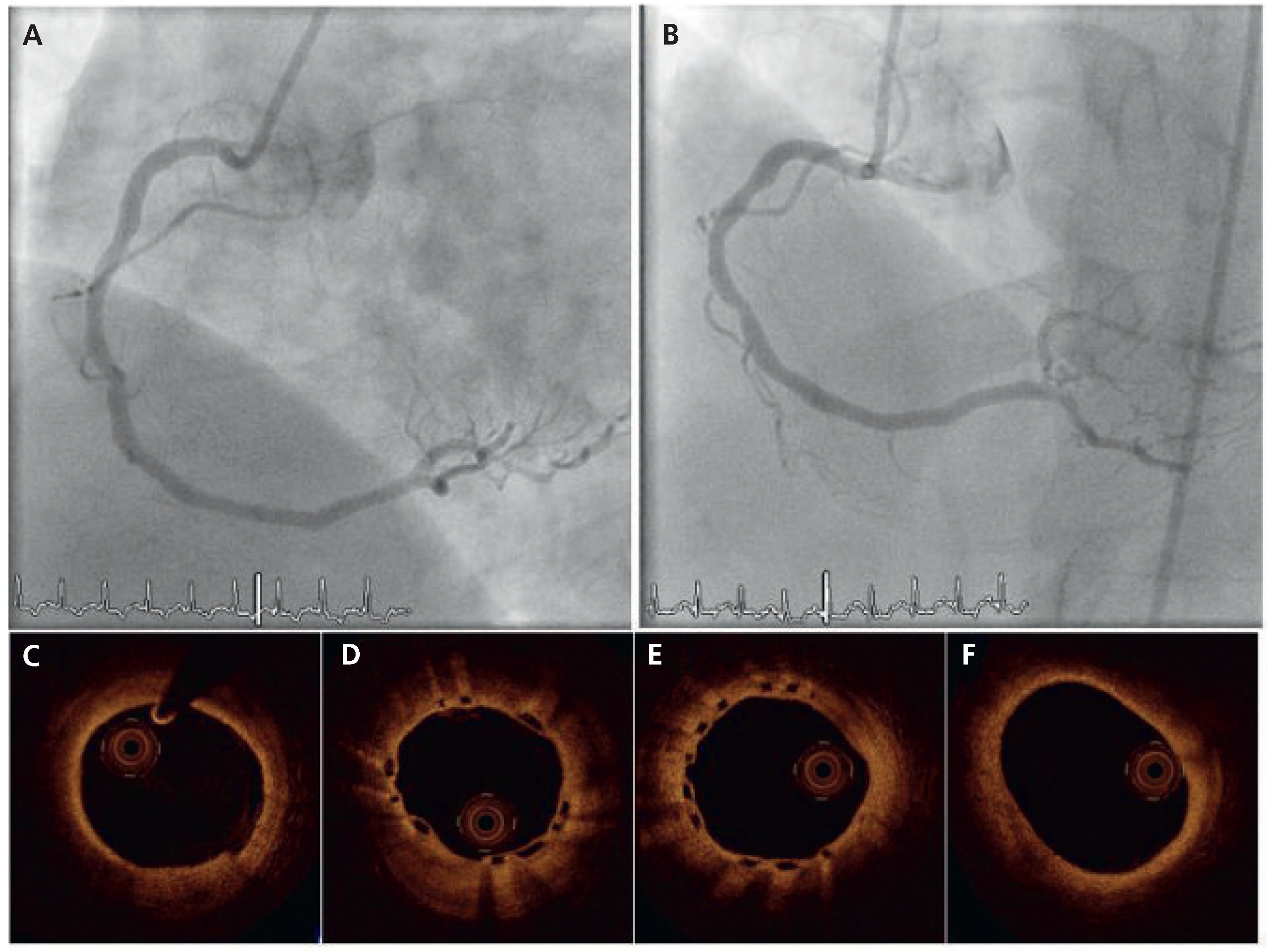Cardiovascmed 14 00067 g002 Cardiovascmed 14 00067 g002