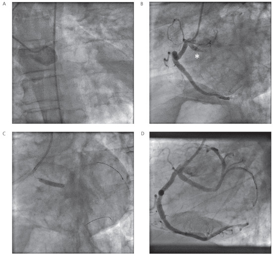 Cardiovascmed 14 00195 g001