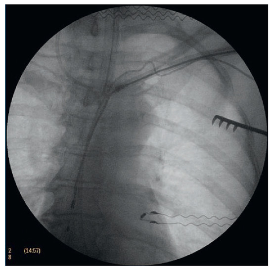 Cardiovascmed 14 00213 g003
