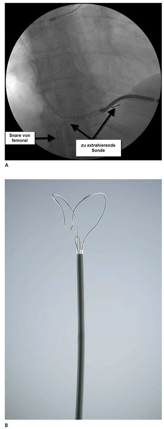 Cardiovascmed 14 00213 g006