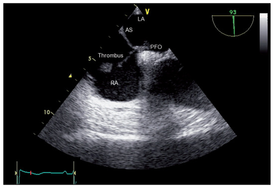 Cardiovascmed 14 00229 g001