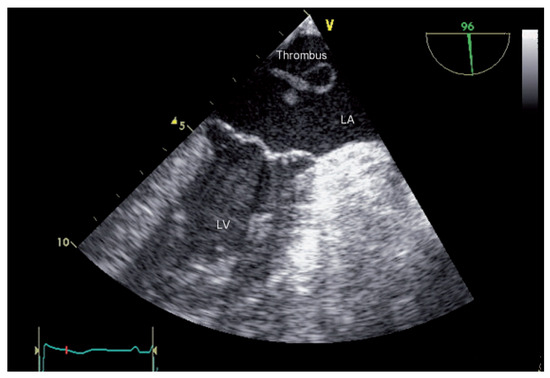 Cardiovascmed 14 00229 g002