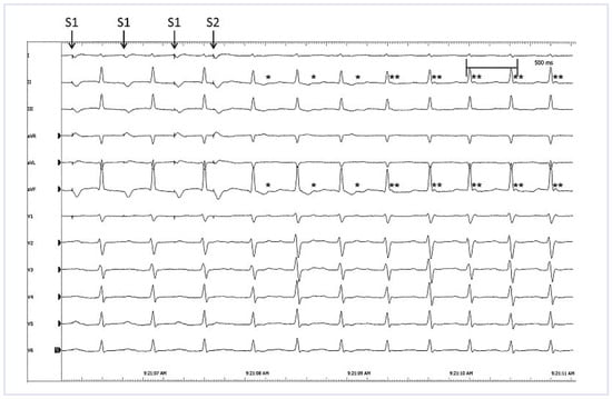 Cardiovascmed 14 00294 g002