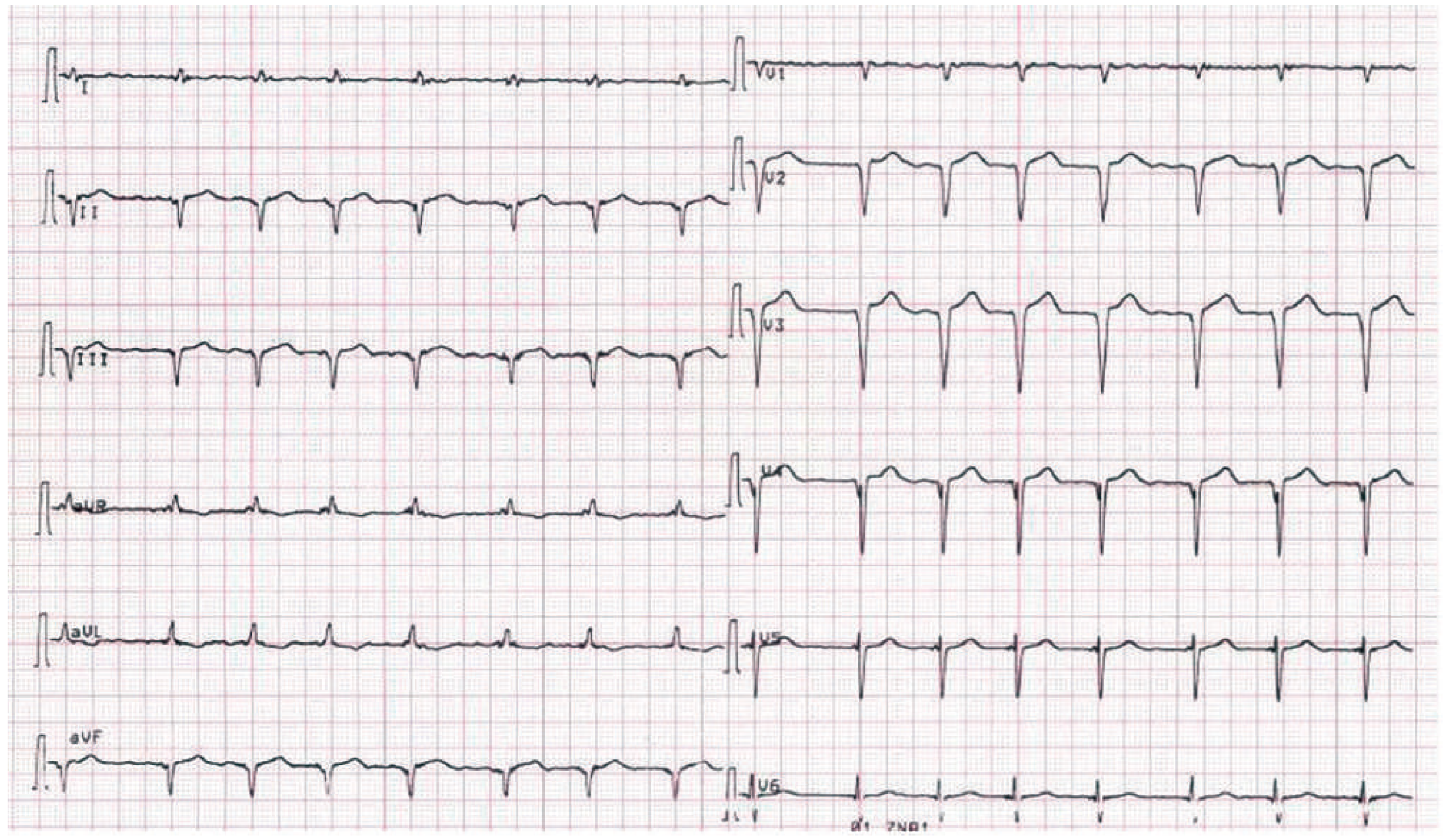 Cardiovascmed 15 00030 g001 Cardiovascmed 15 00030 g001