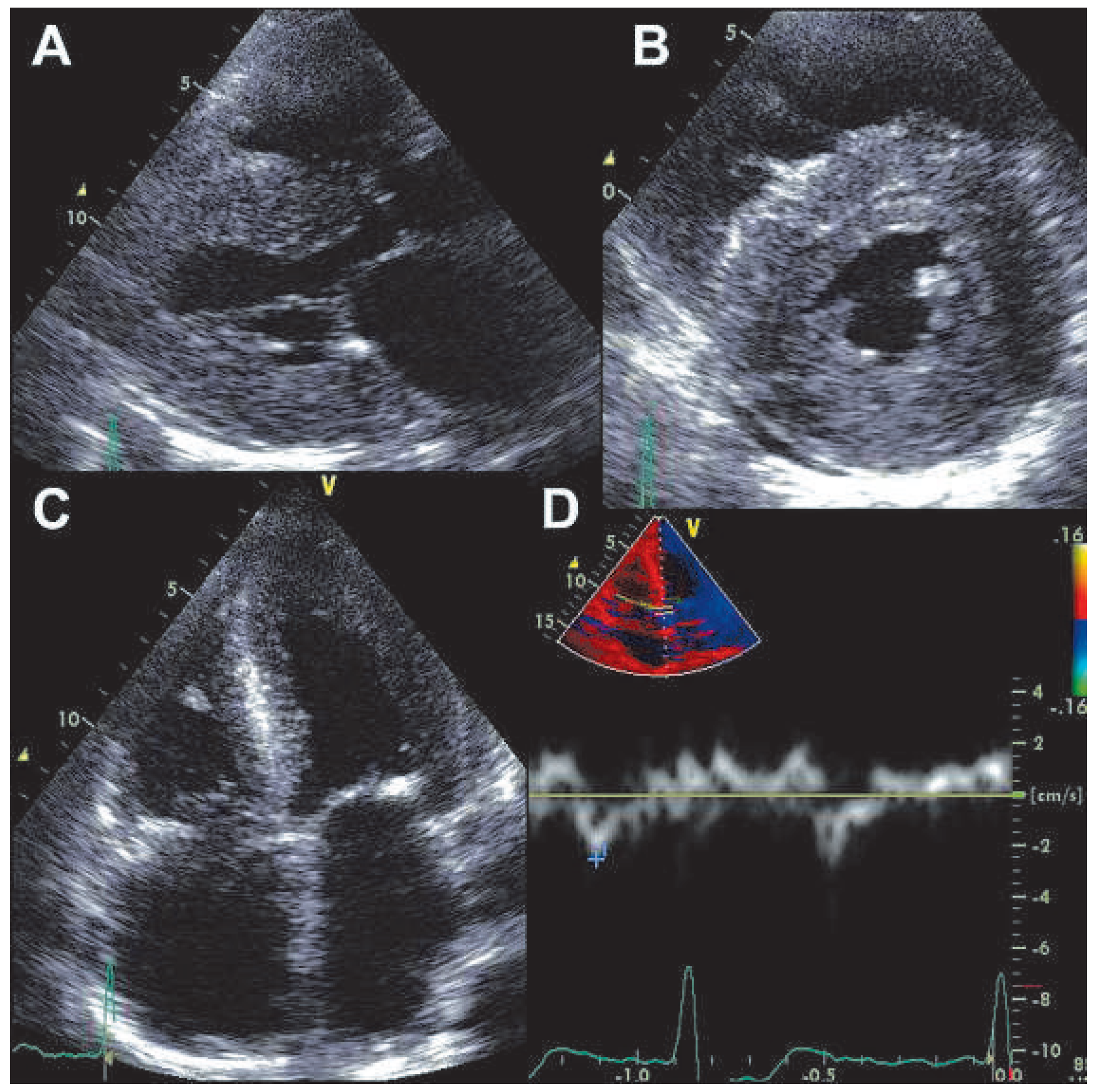 Cardiovascmed 15 00030 g002 Cardiovascmed 15 00030 g002
