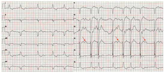 Cardiovascmed 15 00208 g001