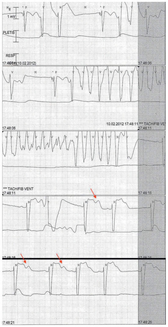 Cardiovascmed 15 00208 g002
