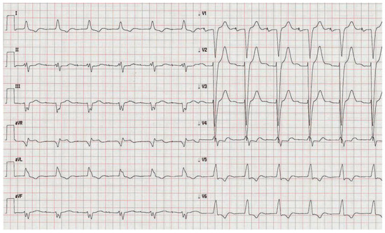 Cardiovascmed 15 00208 g003