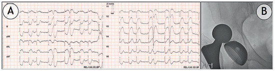 Cardiovascmed 15 00226 g001a