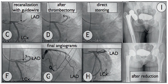 Cardiovascmed 15 00226 g001b