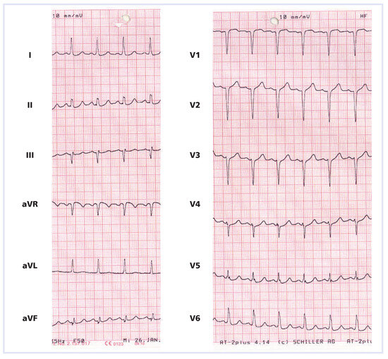 Cardiovascmed 15 00230 g001