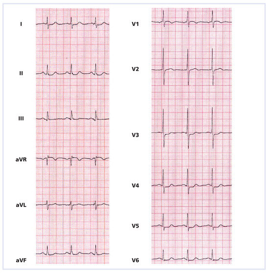 Cardiovascmed 15 00230 g002