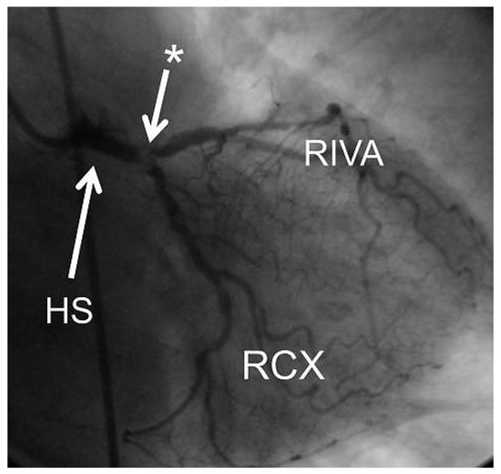 Cardiovascmed 15 00230 g004