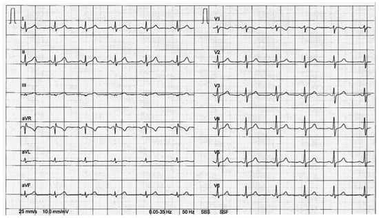 Cardiovascmed 15 00233 g001