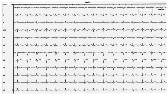 Cardiovascmed 15 00233 g004