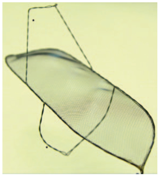 Cardiovascmed 15 00287 g002