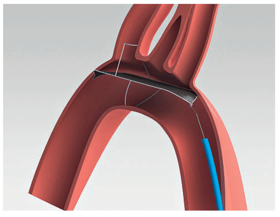 Cardiovascmed 15 00287 g003