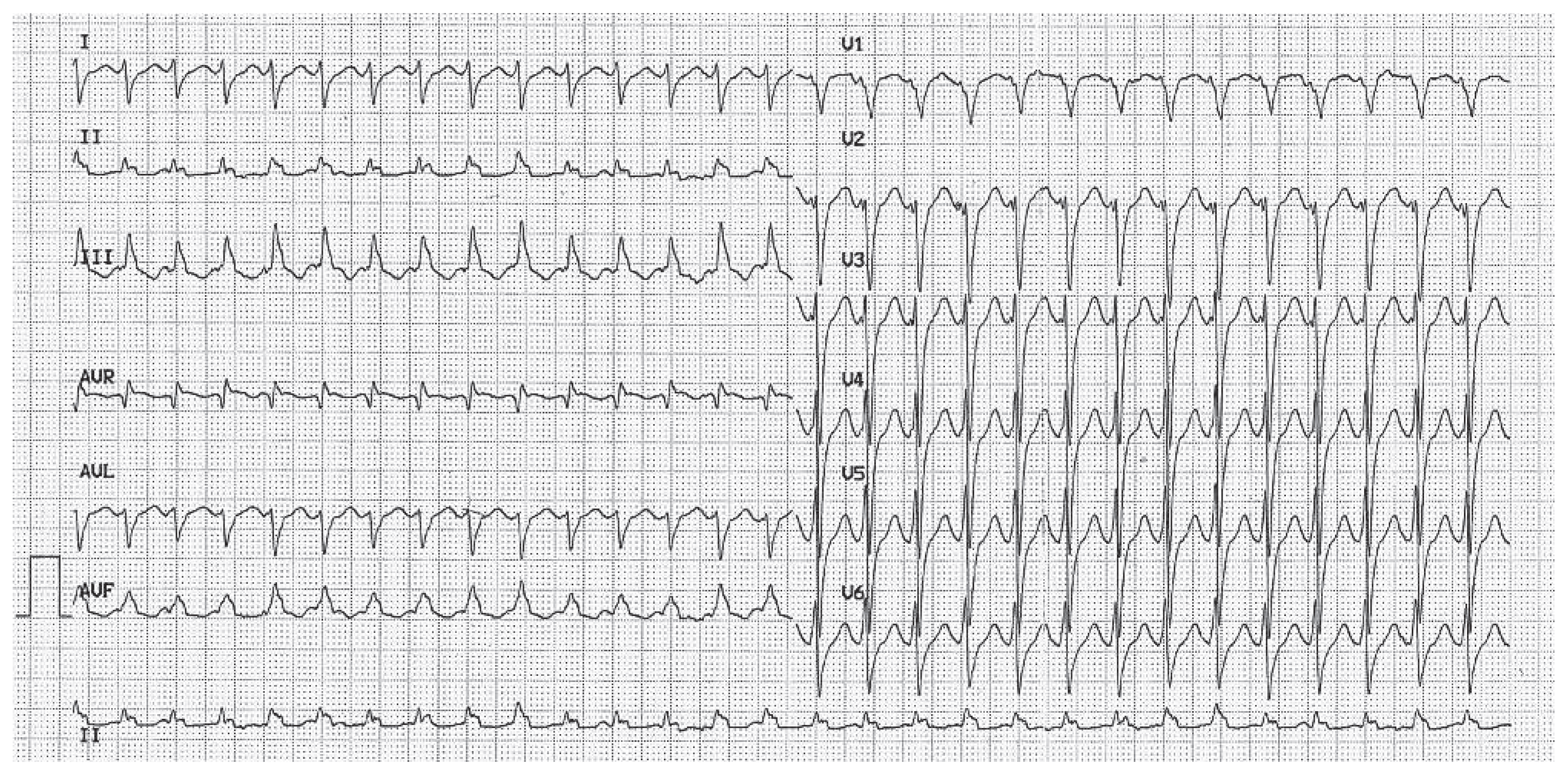 Cardiovascmed 15 00296 g001 Cardiovascmed 15 00296 g001