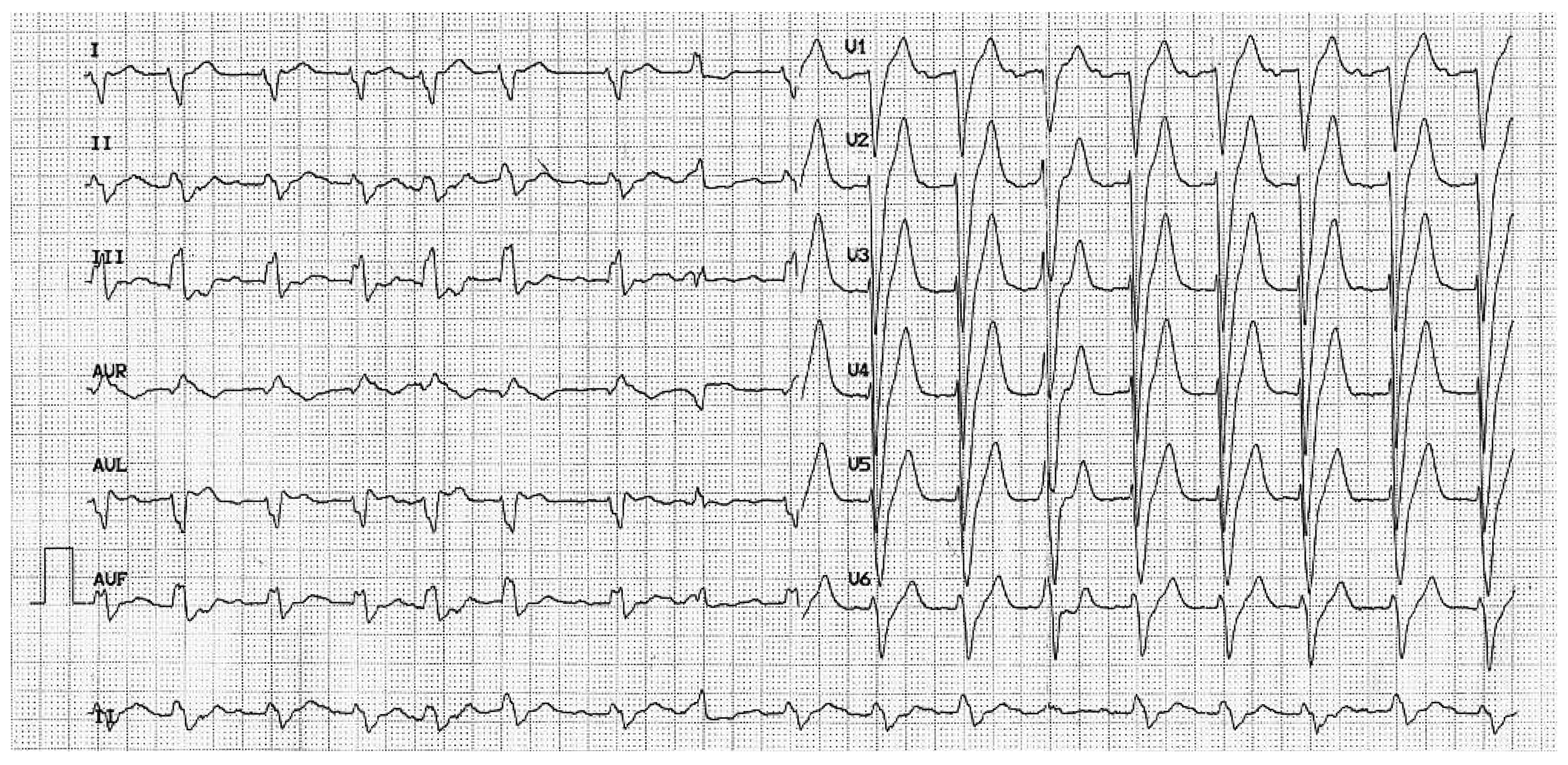 Cardiovascmed 15 00296 g002 Cardiovascmed 15 00296 g002