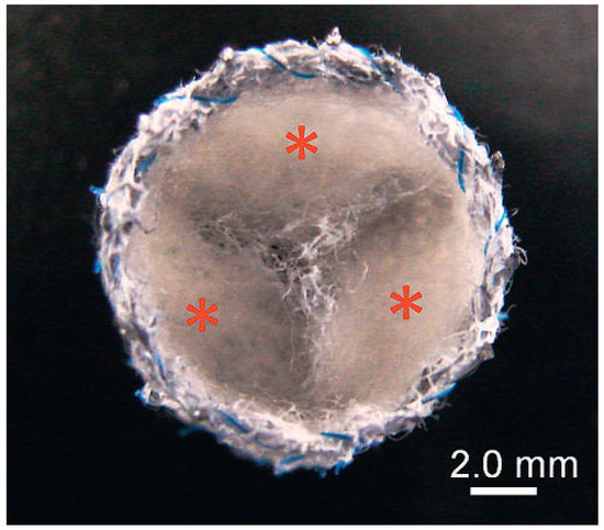 Cardiovascmed 15 00339 g002