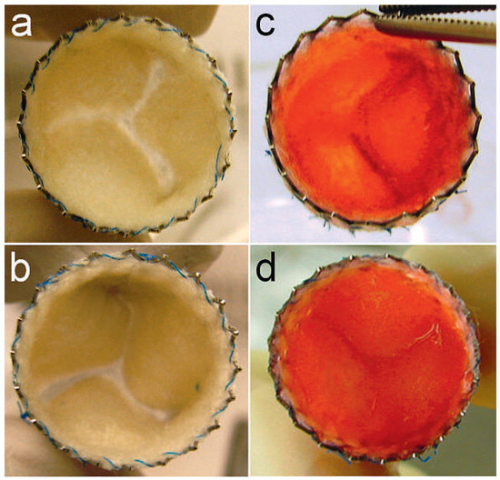 Cardiovascmed 15 00339 g004
