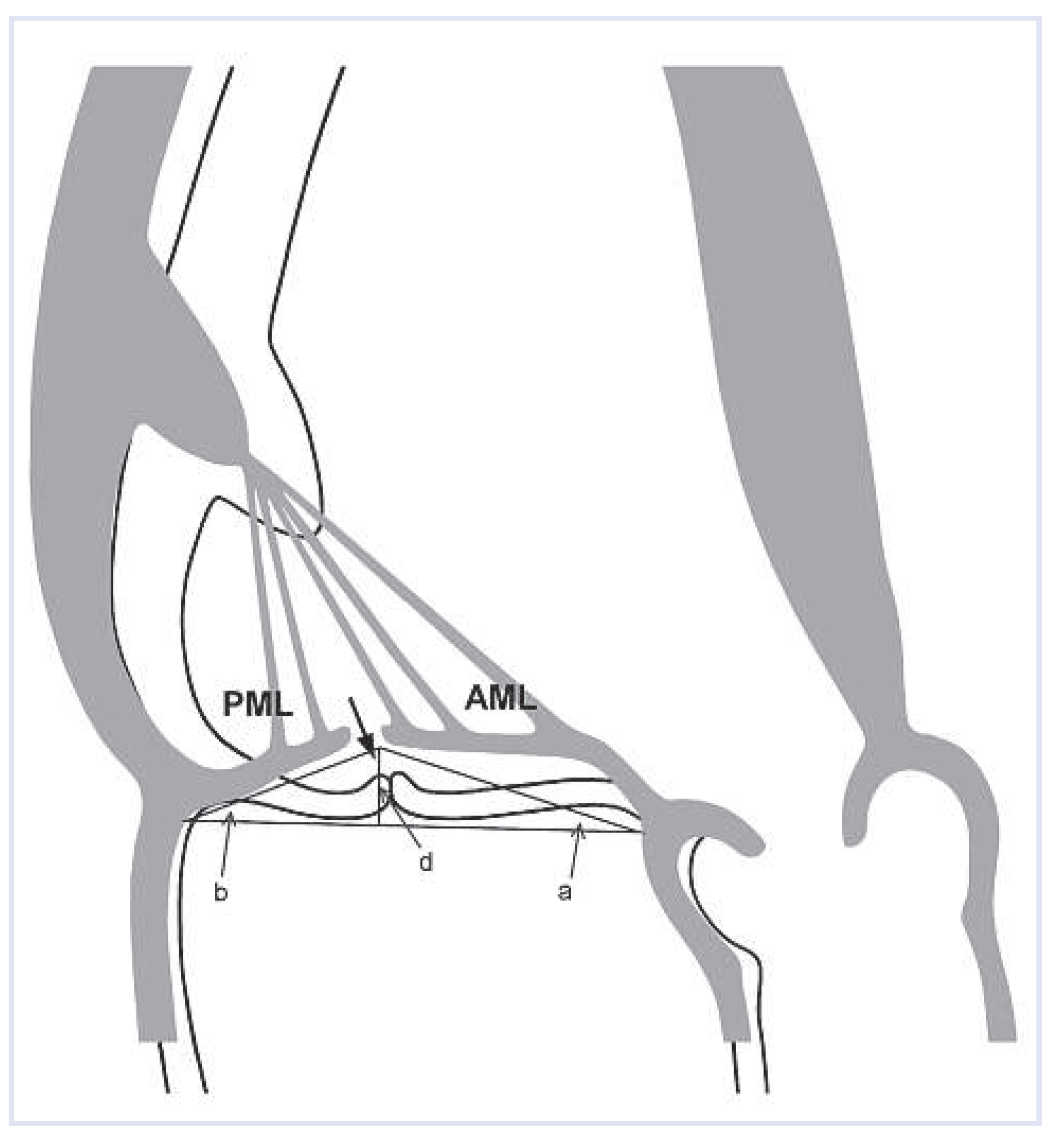 Cardiovascmed 16 00082 g001