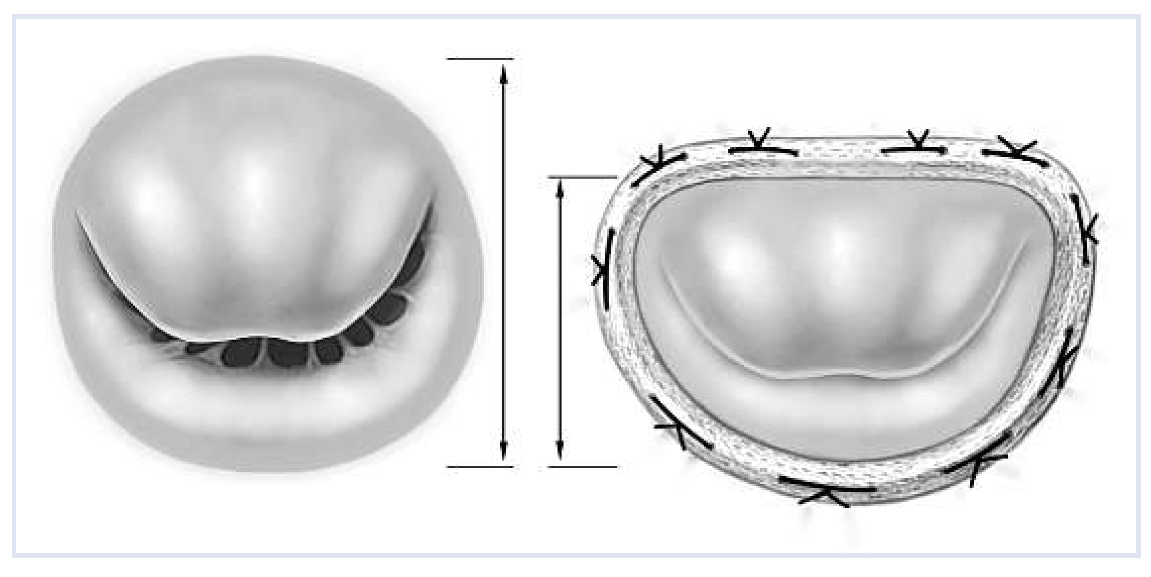Cardiovascmed 16 00082 g002